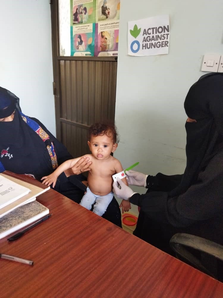 trabajadoras comunitarias miden la circunferencia del brazo de una niña yemení que sufre complicaciones por malnutrición