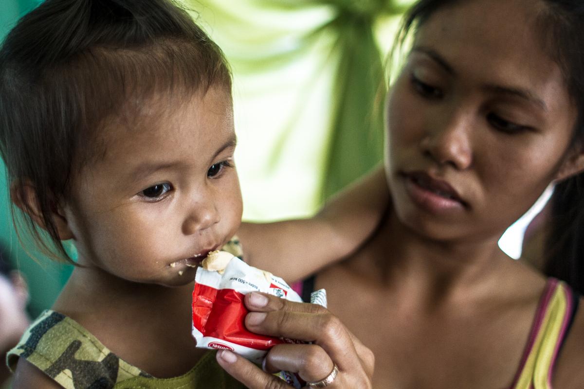 La desnutrición crónica es más común en países menos desarrollados.