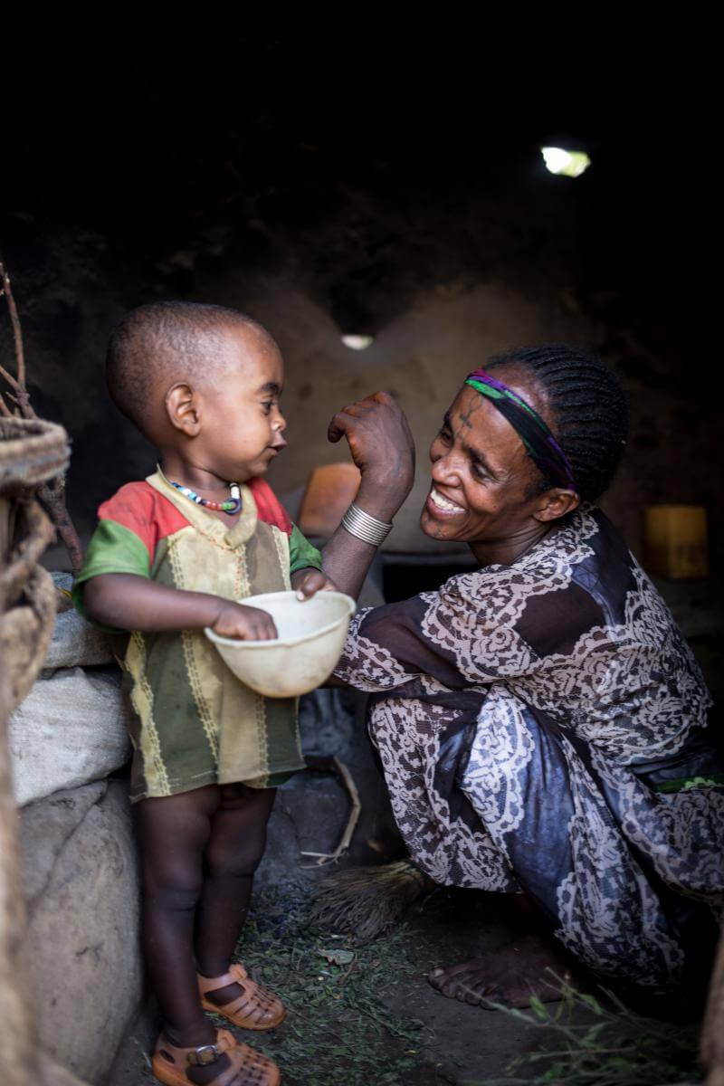 Etiopía, desnutrición, hambre