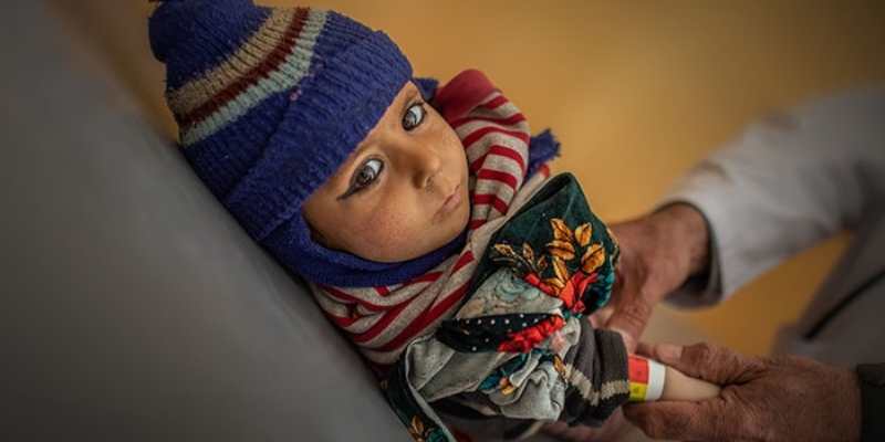La desnutrición se extiende entre los niños y niñas afganos. 