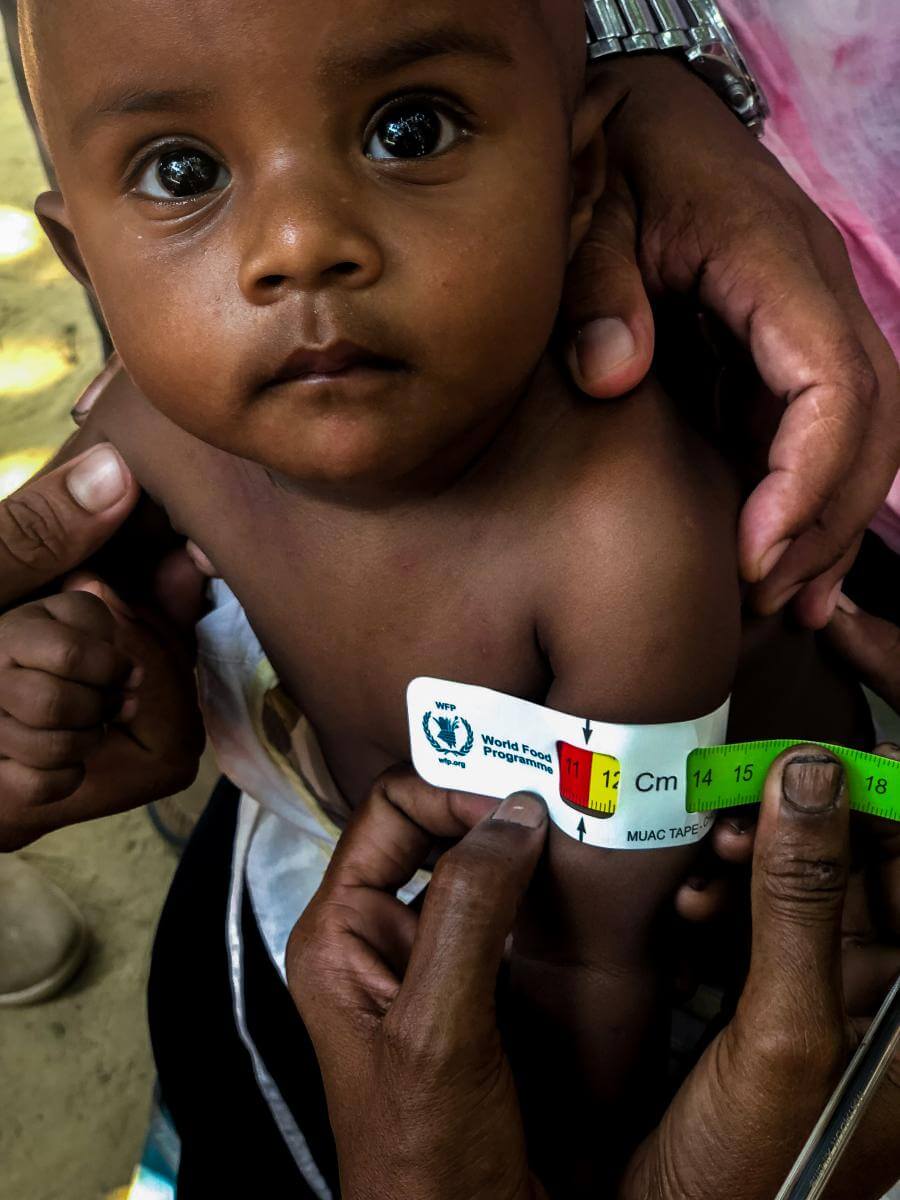 rohingya, Bangladesh, desnutrición, refugiados