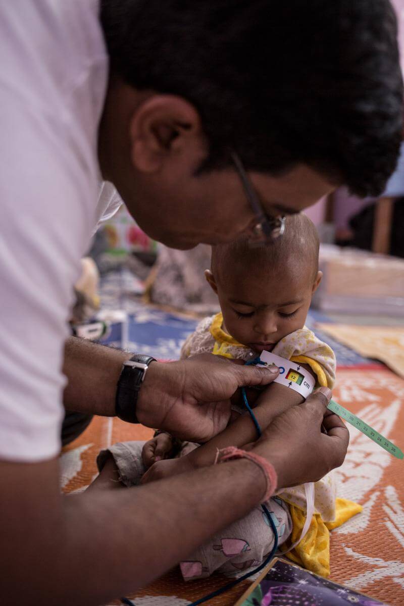 Bebé, niña, desnutrición, tratamiento, India