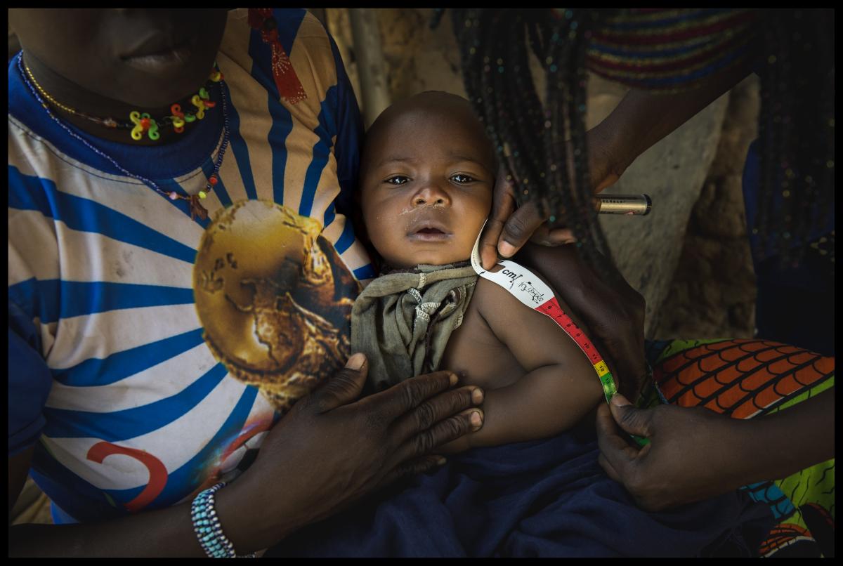 La población infantil es una de las más afectadas por la enfermedades mortales en África.