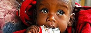 Tratamiento médico-nutricional para un niño desnutrido