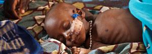 Puedes salvar la vida de un niño con desnutrición y complicaciones médicas