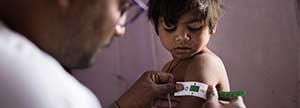 Tratamiento médico de varios niños con desnutrición severa aguda