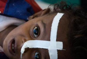 Yemen: la reanudación de las hostilidades hace temer un empeoramiento de la situación humanitaria