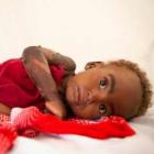 La historia de Amina o cómo vencer a la desnutrición