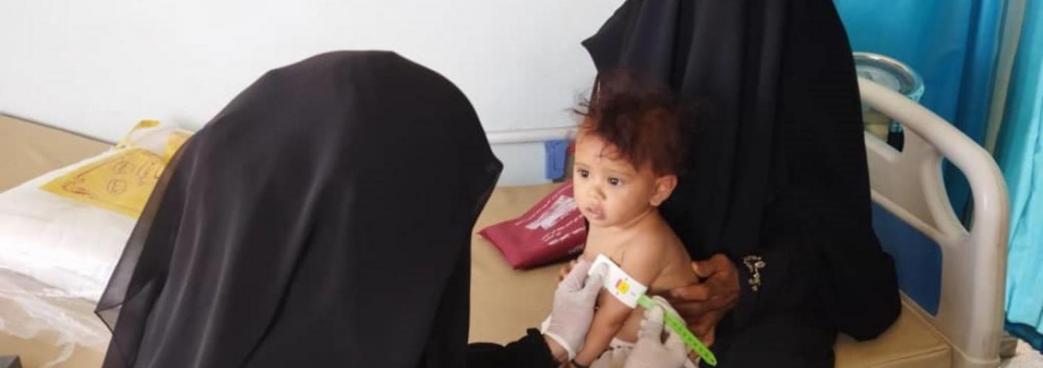 Ahood, una niña yemení, sufre complicaciones por malnutrición