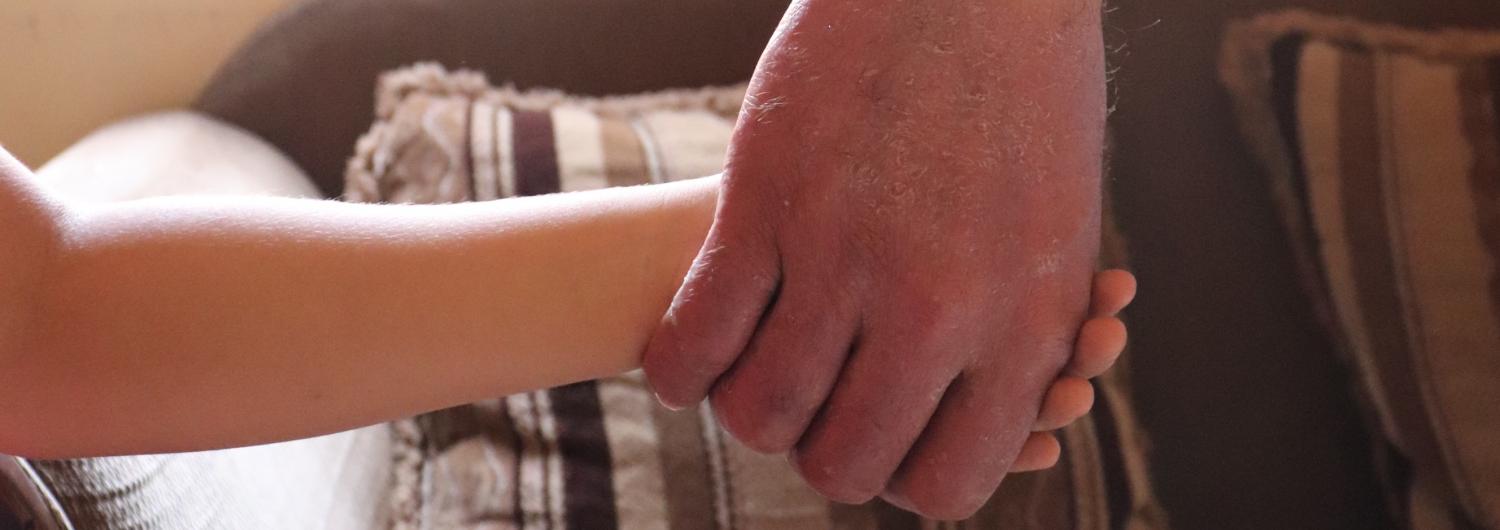 un padre con eczema y su hija de 5 años se dan la mano